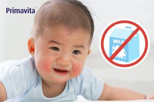 dị ứng sữa bò