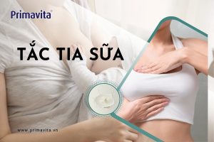 cách làm tan cục sữa tắc