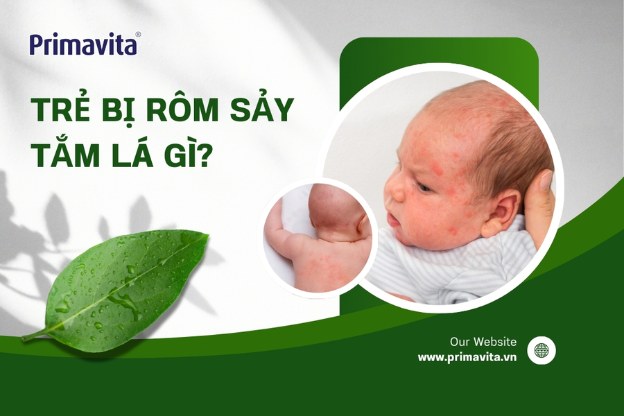 Trẻ bị rôm sảy tắm lá gì? 