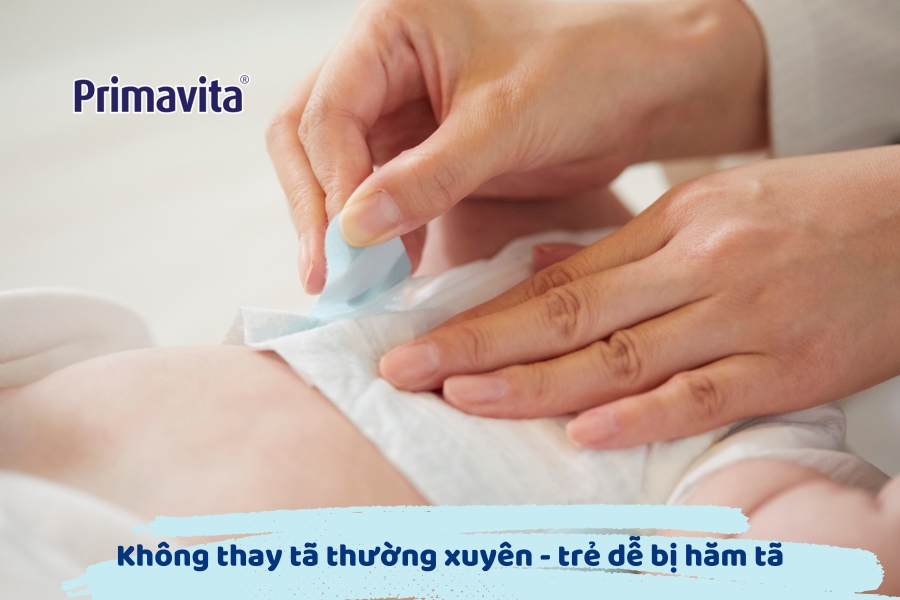 Hăm tã ở trẻ sơ sinh 